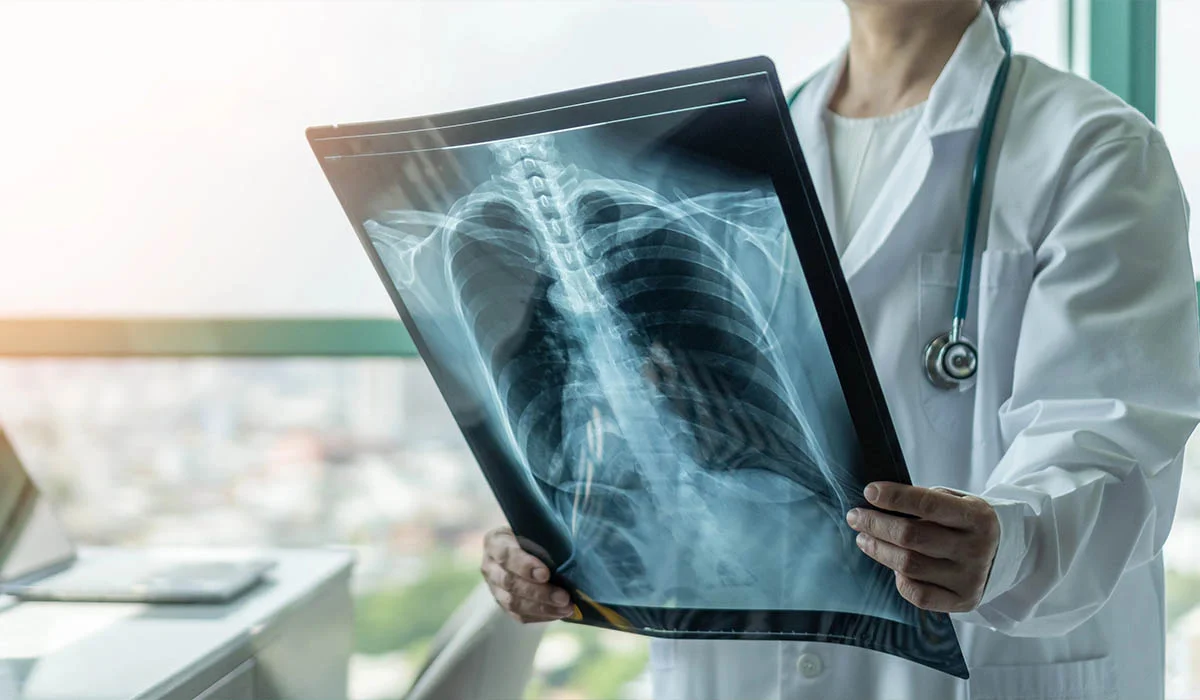 Manipulateur(trice) en radiologie médicale